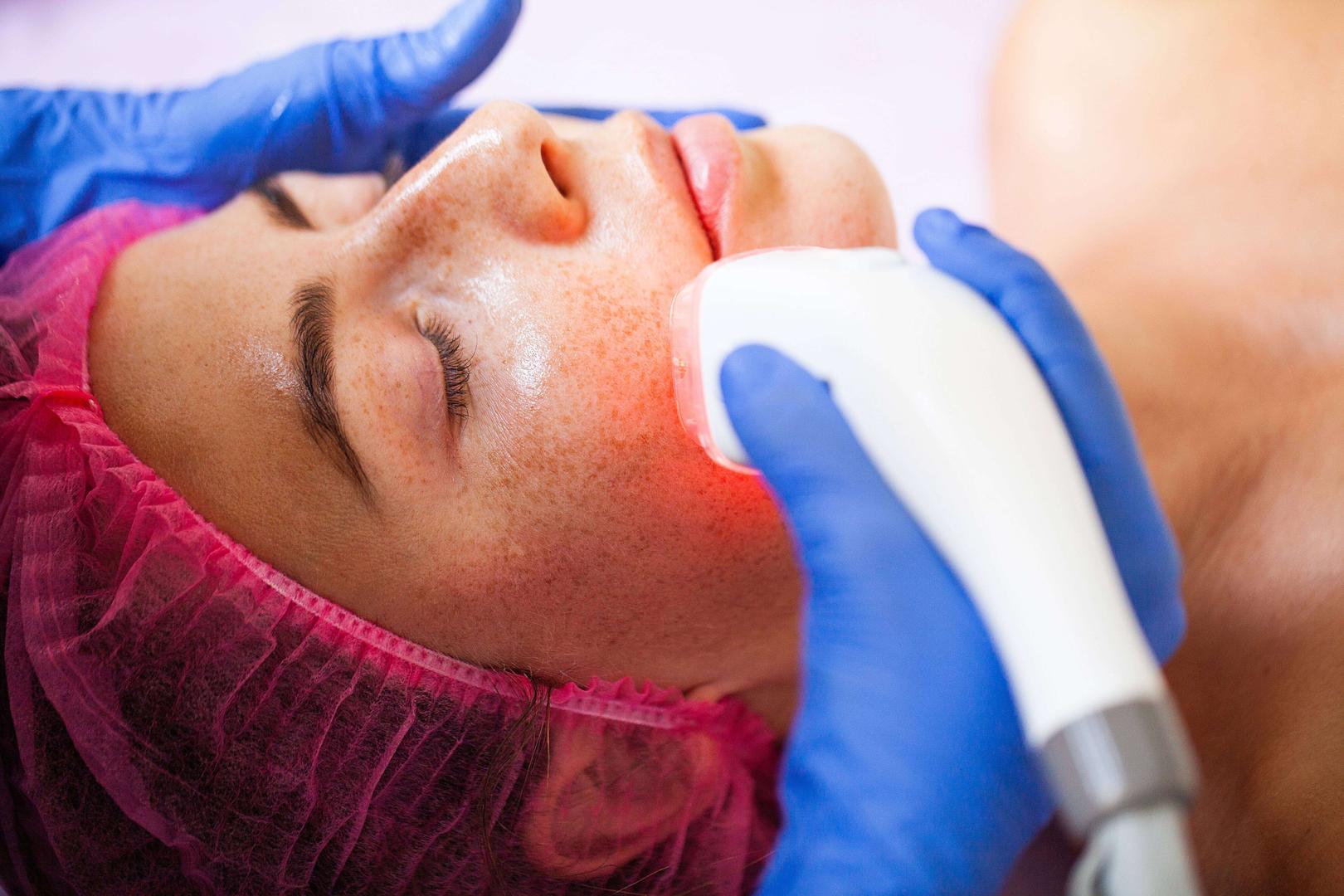 Dermabrazyon Nedir?